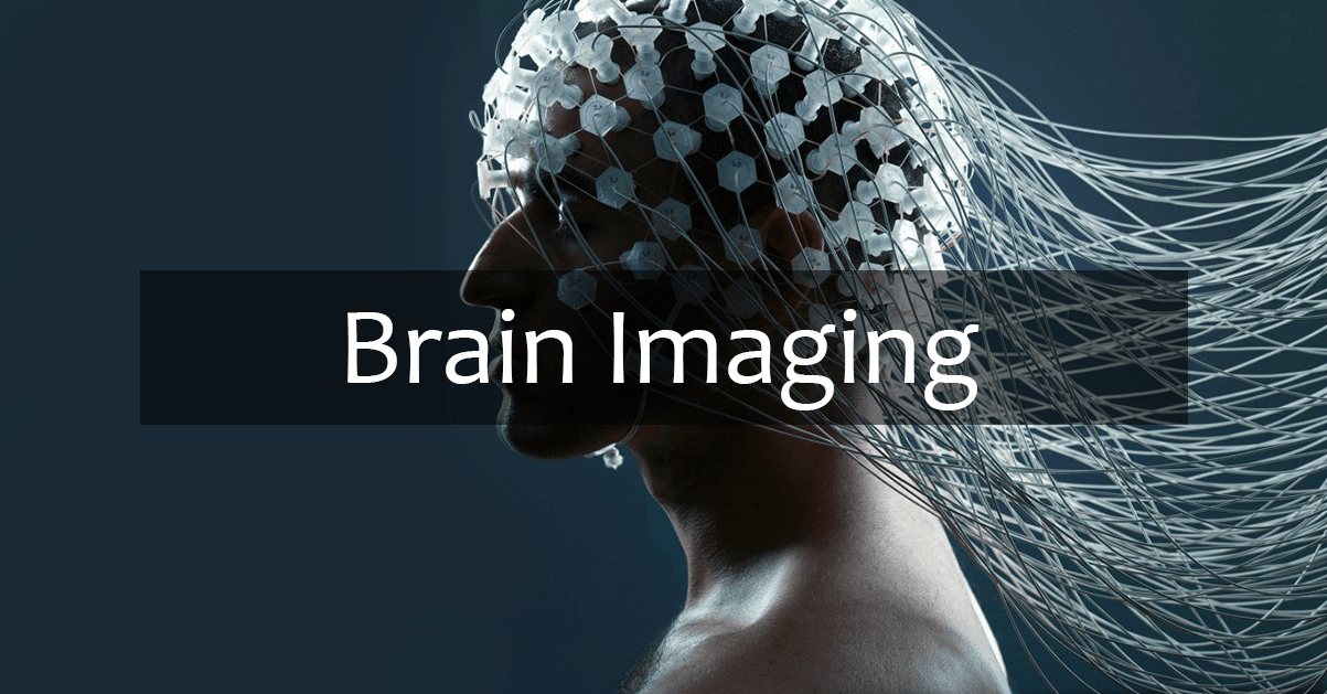 Brain Imaging illustration